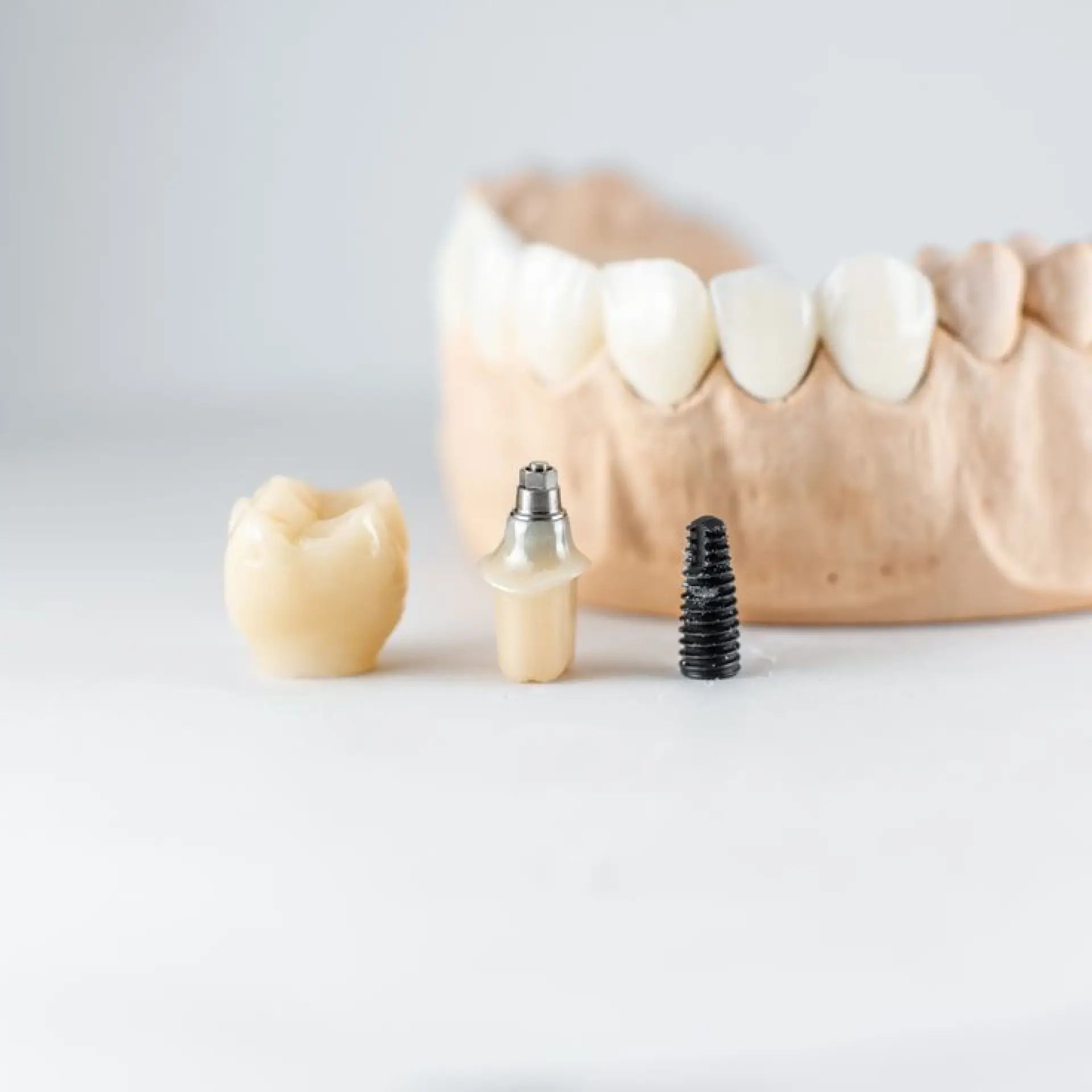 Restorative & Prosthodontics
